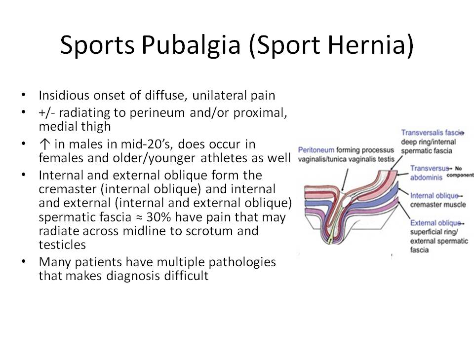 Groin Pain Steven Tippett 2042