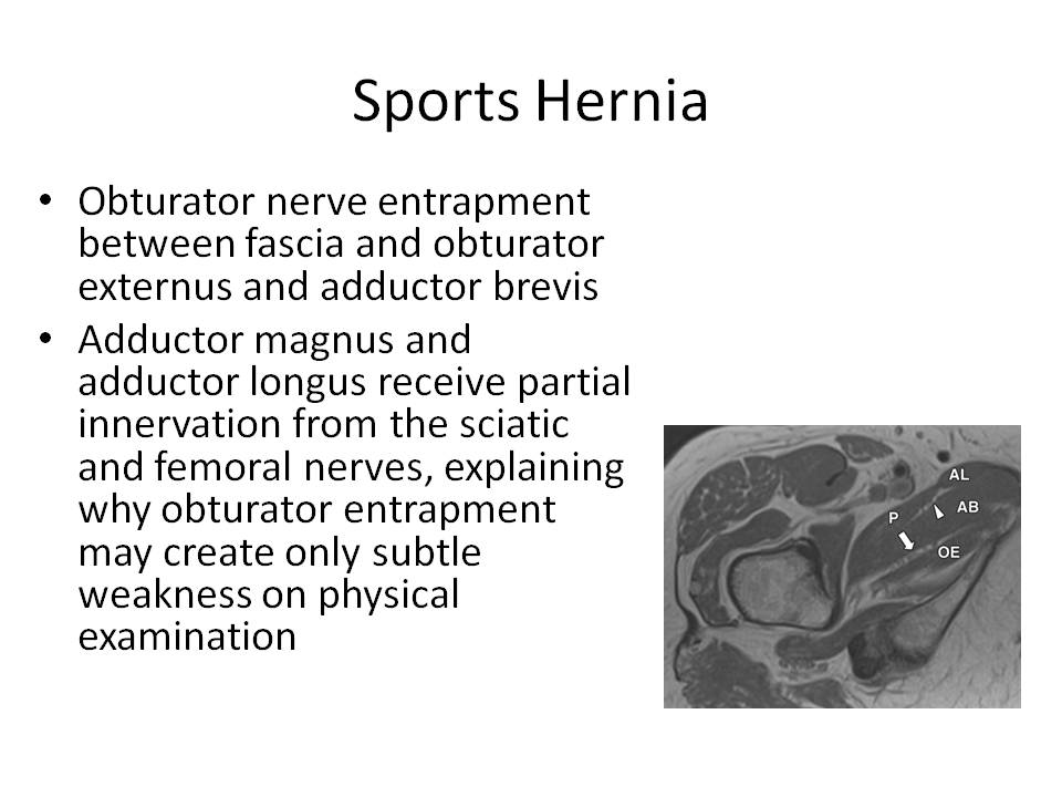 Groin Pain Steven Tippett 2042