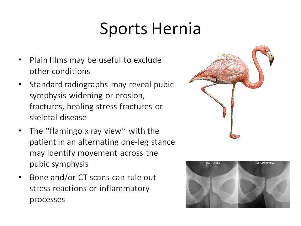 Groin Pain Steven Tippett 2042