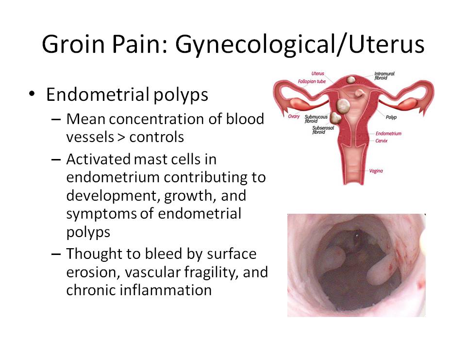 Diagram Of Groin Area / Human Groin Stock Illustrations And Cartoons