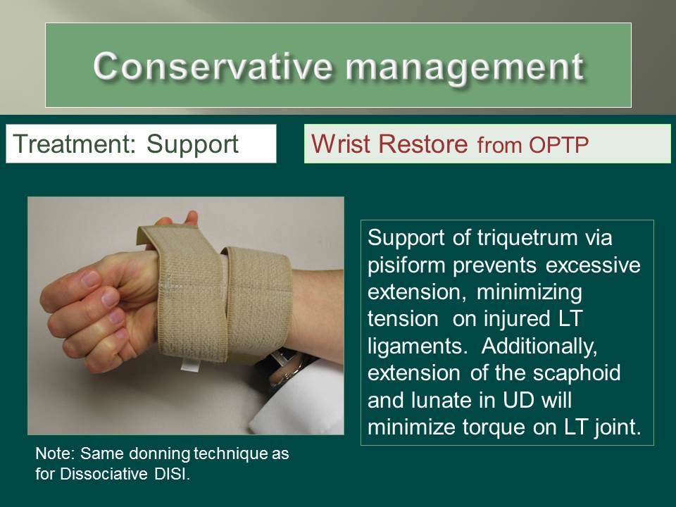 Understanding Wrist Instability Ann PorrettoLoehrke Sports Orthopedics