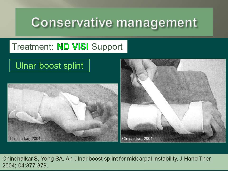 Understanding Wrist Instability Ann PorrettoLoehrke Sports Orthopedics