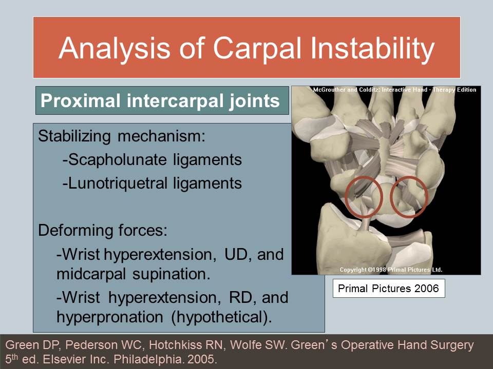 Understanding Wrist Instability Ann PorrettoLoehrke Sports Orthopedics