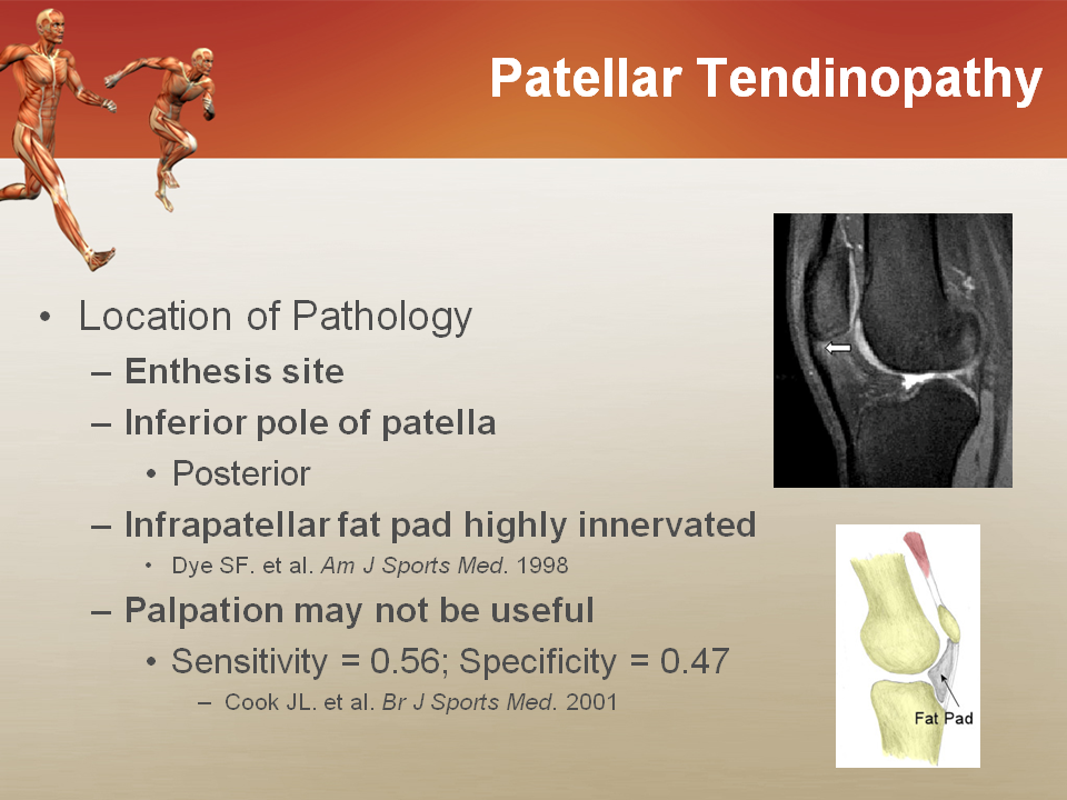 Management Of Lower Extremity Tendinopathy David Nolan Orthopedics