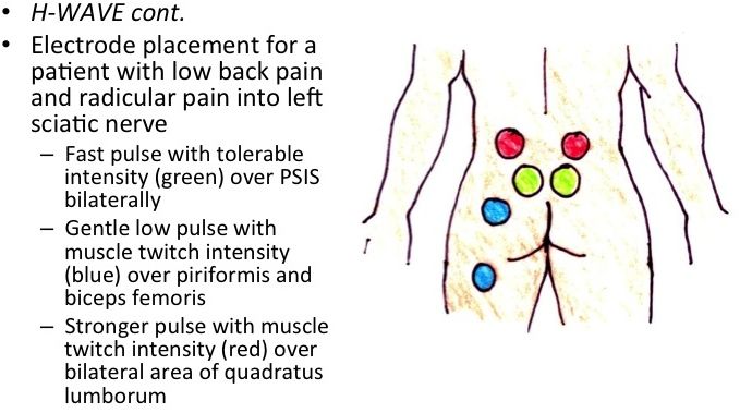 lumbar-spine-ellen-pong-orthopedics-2907